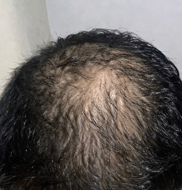 Before treatment