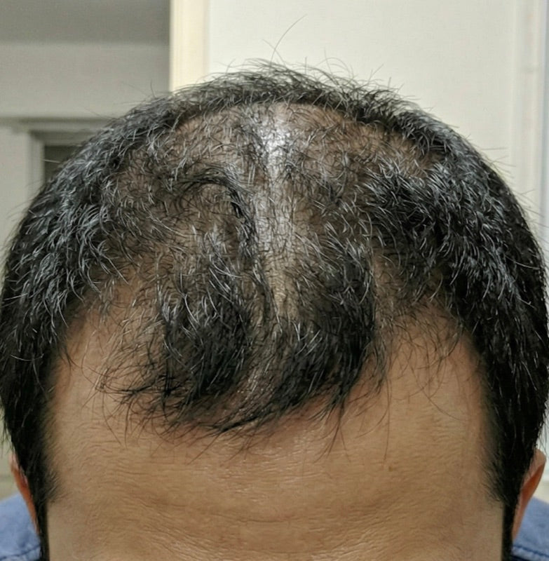 Before treatment